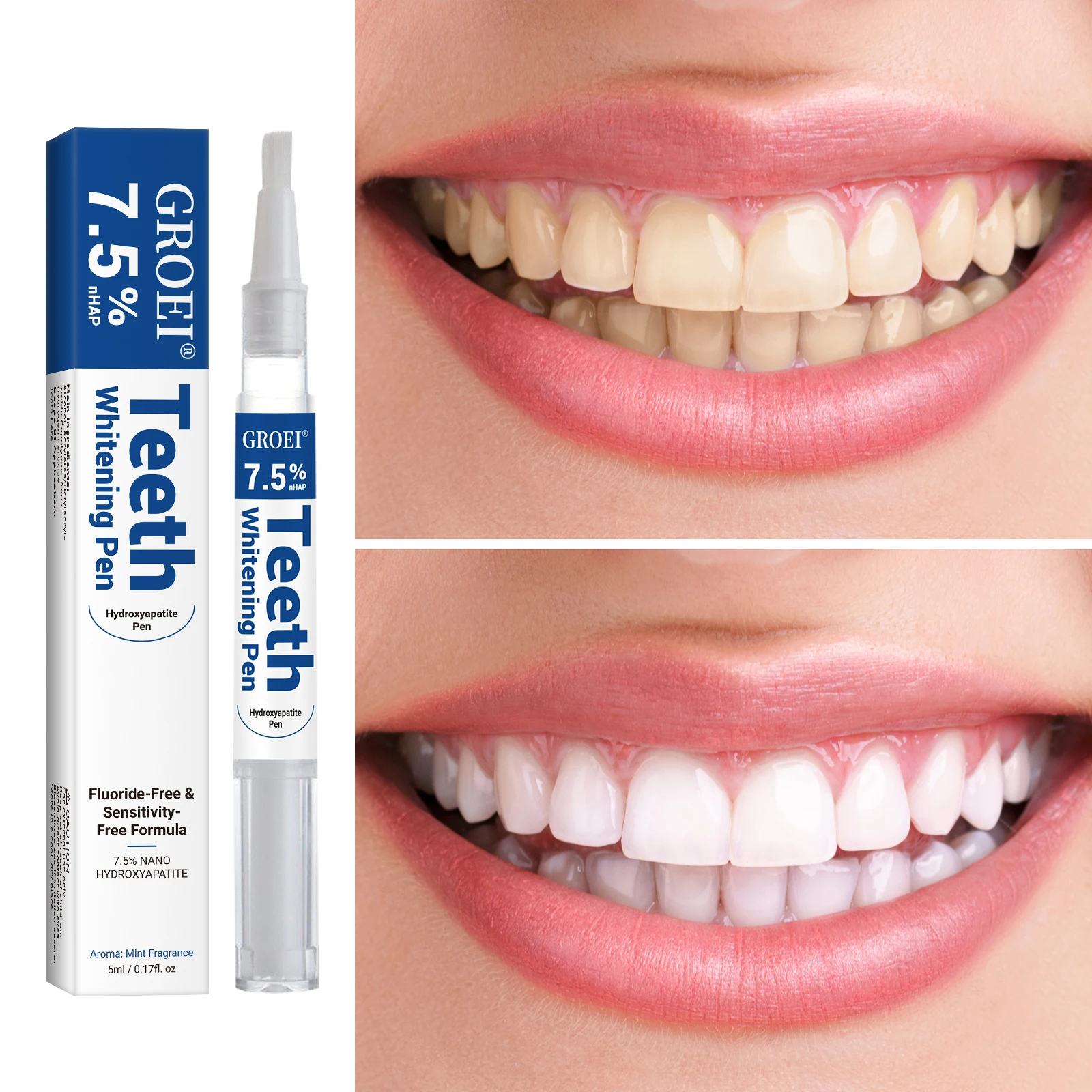 Гидроксипатитовая ручка для от – обзор и цена Teeth Whitening Near Me