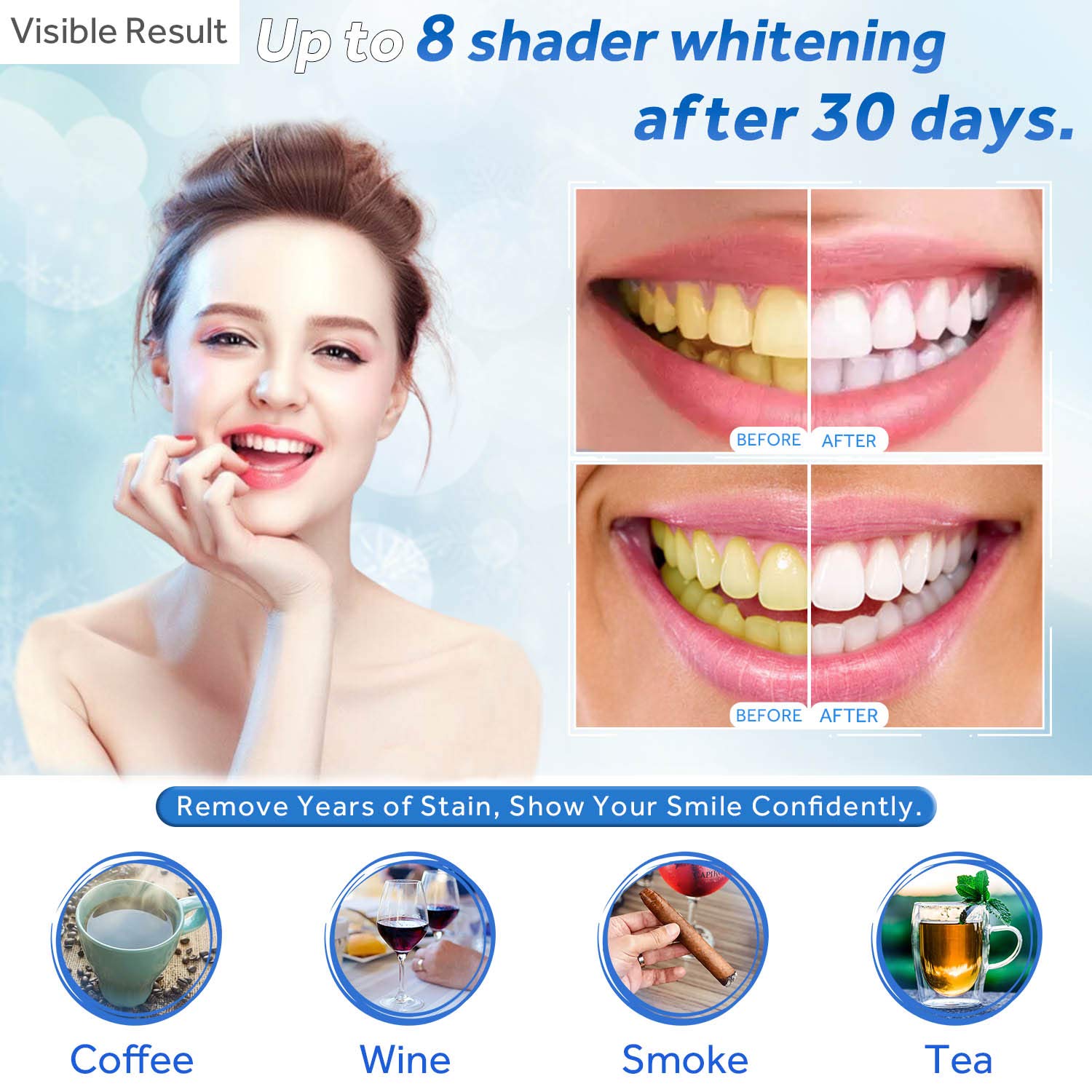 Гель для отбеливания зубов, шп – обзор и цена Teeth Whitening Near Me