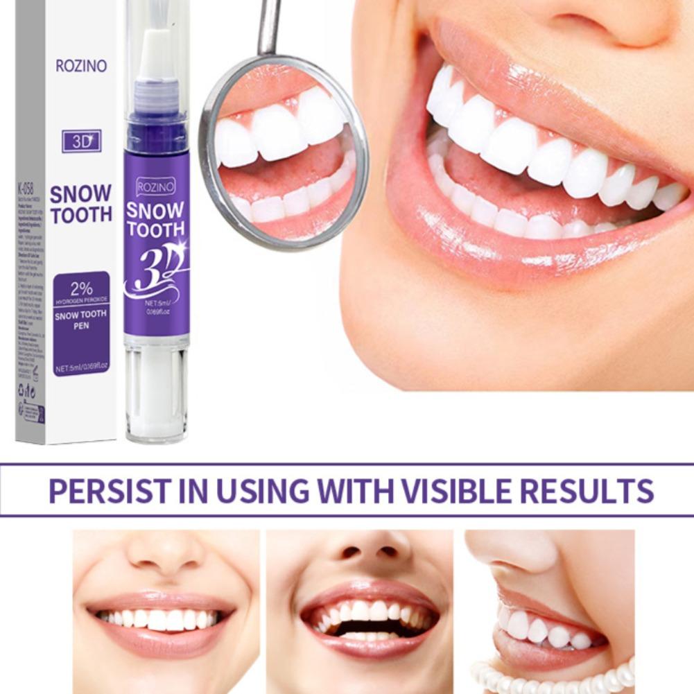 Универсальная ручка для ухода  – обзор и цена Teeth Whitening Pens