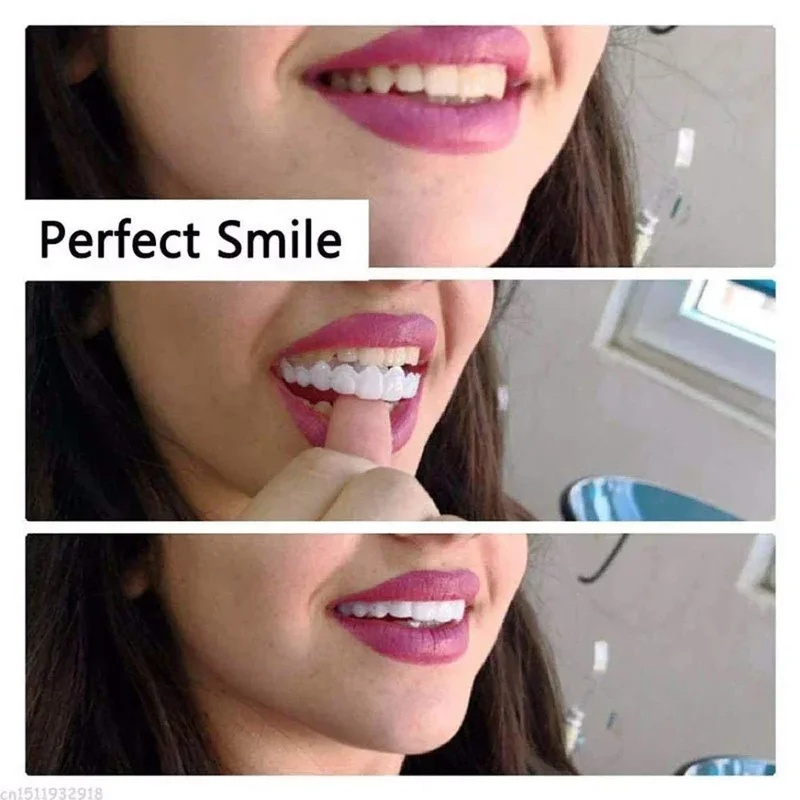 Набор временных косметических  – обзор и цена Teeth Whitening Kit